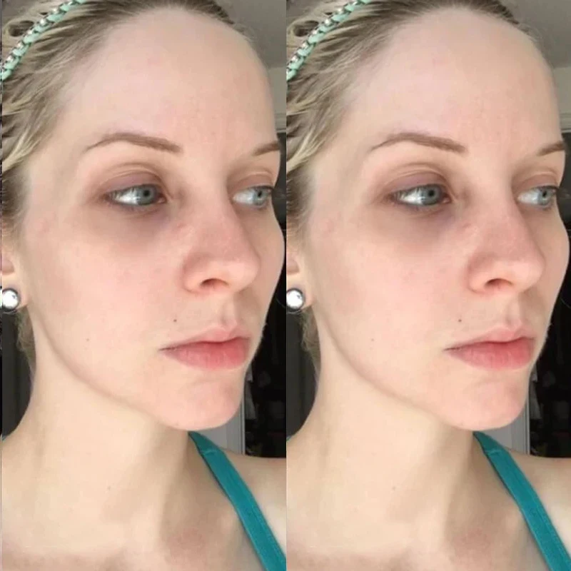 Korean Collagen Hyaluronic Acid Face Mask Repair Firming Lifting Improve Fine Lines Brighten Moisturiz Peptide Essence Skin Care - Image 6