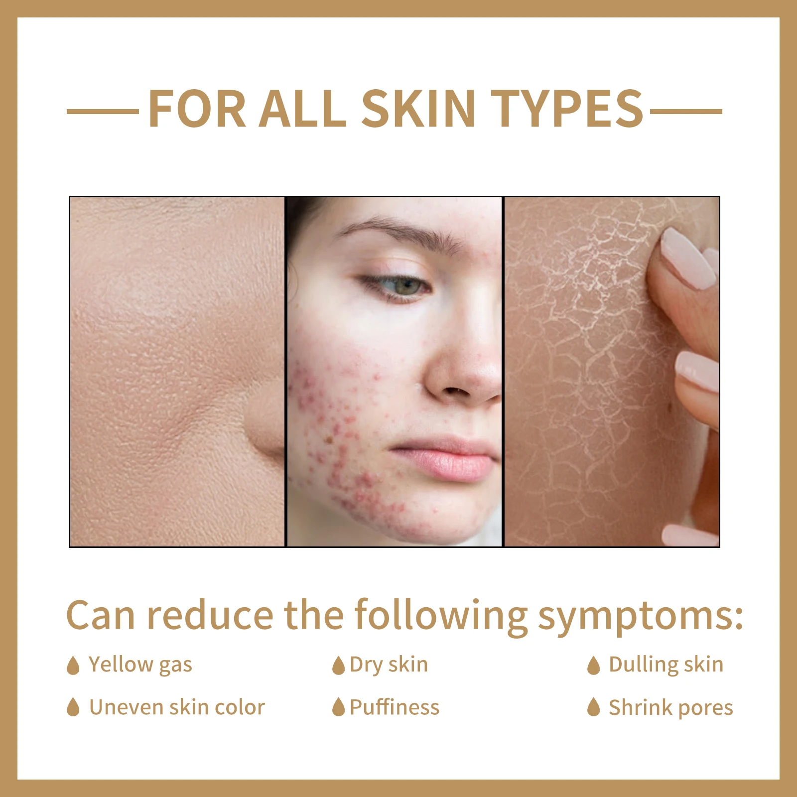 Rice Moisturizing Toner Repairs Damaged Skin Firms Tighter Skin Softens Lines And Wrinkles Shrinks Pores And Brightens Skin Tone - Image 5