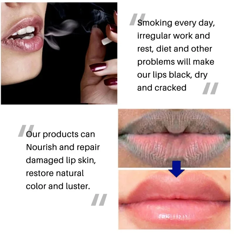 Remove Dark Lip Balm Lightening Melanin Mask Gloss Oil Exfoliating Clean Moisturizer Makeup Beauty Health Care Products New 2024 - Image 6
